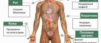 Areas prone to candidiasis infection